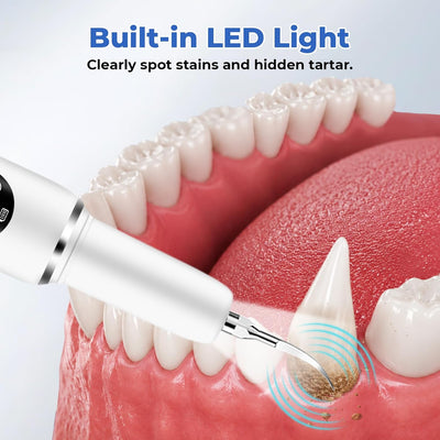 Ultrasonic Dog Toothbrush & Dental Kit